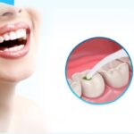 Dental Floss Benang Sikat Pembersih Sela Gigi Isi 30 Pcs - Isi 30 - Image 6