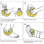 Kantong Kompres Dingin Panas Kompres Pereda Demam Memar Cedera Nyeri - Image 5