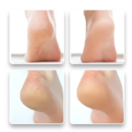 Kaos Kaki Untuk Perawatan Tumit Membantu Mengatasi Kulit Pecah - Image 7