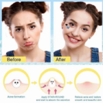 Acne Pimple Patch Stiker Penghilang Jerawat Skin Repair Bentuk Unik - Image 3