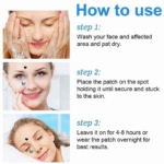Acne Pimple Patch Stiker Penghilang Jerawat Skin Repair Bentuk Unik - Image 5